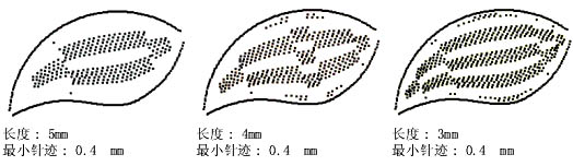 如何用自动分割针迹来分割长针迹